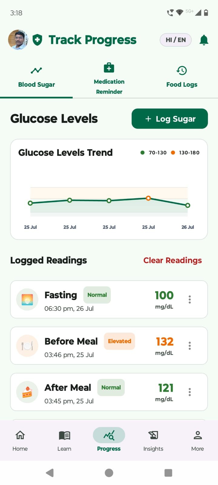 Blood Sugar Glucose Levels & Trends